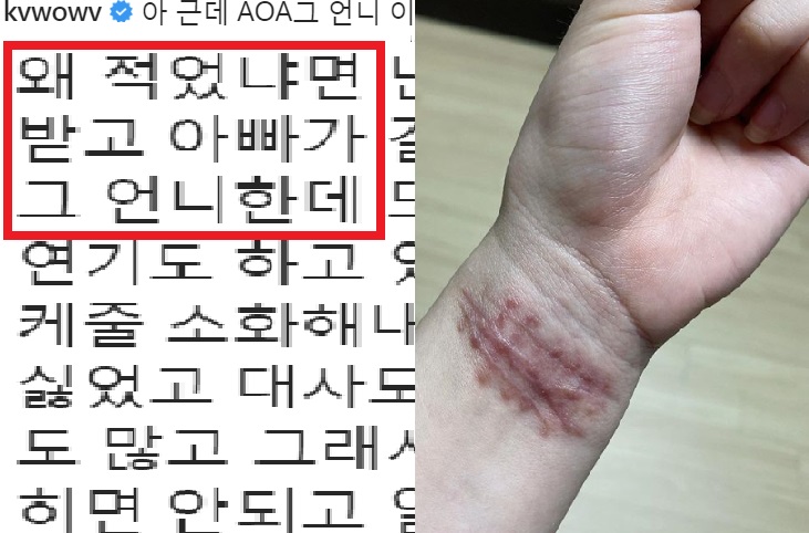 권민아, aoa 지민 에게 손목 사진 보내며 한 말 (+유경 인스타)